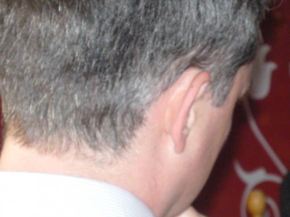 P1000665